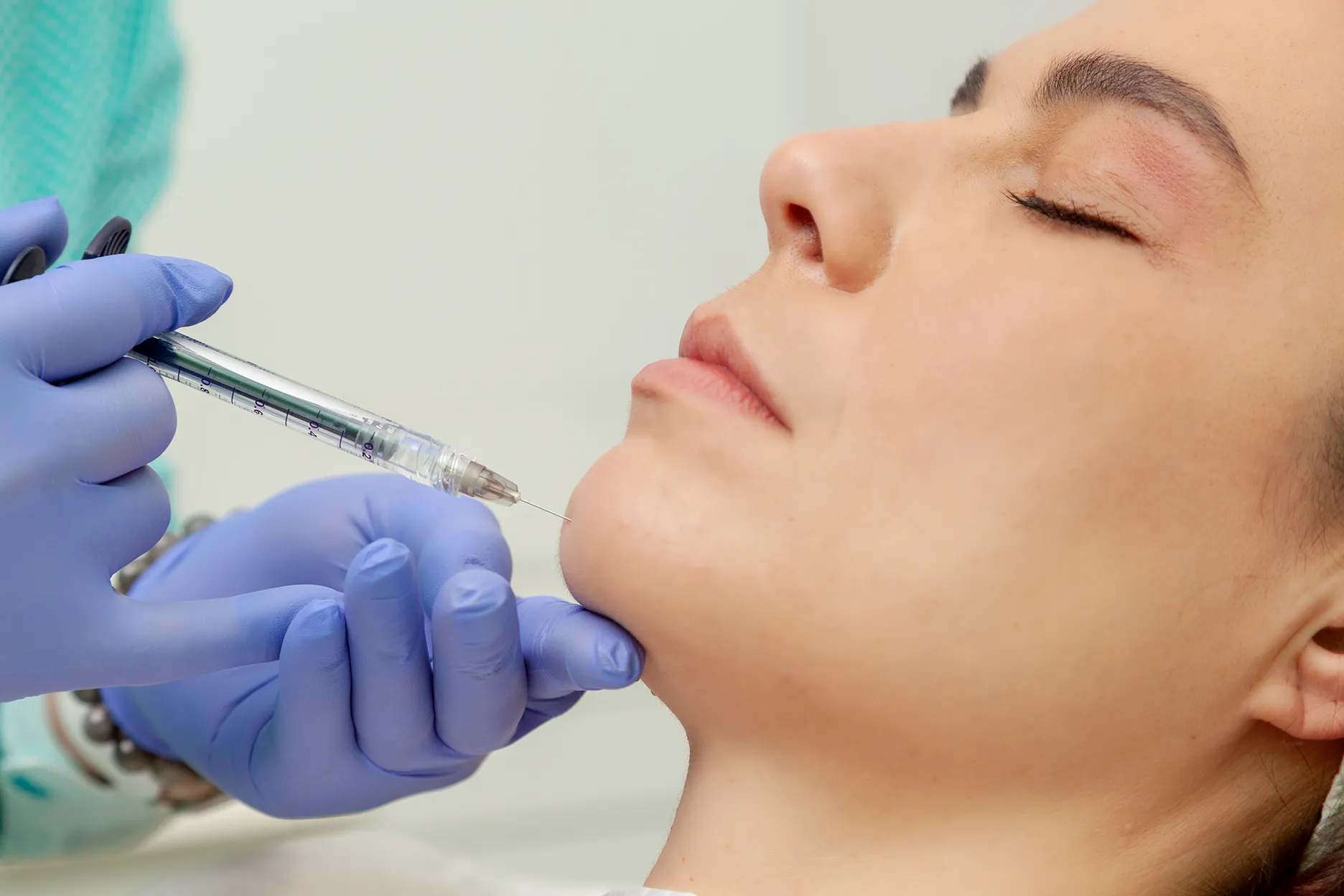 Jawline (Çene Dolgusu) Nedir? Nasıl Yapılır?