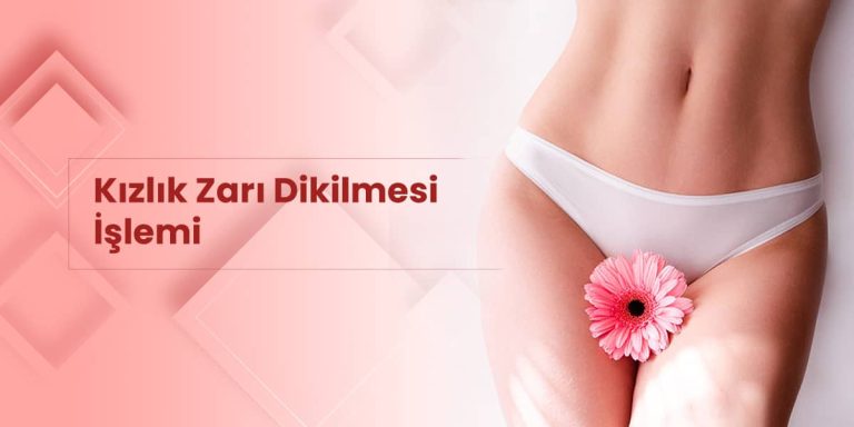 Kızlık Zarı Dikimi Yorumları