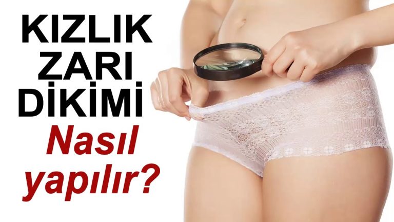 Kızlık Zarı Dikimi Sonrası Yorumlar