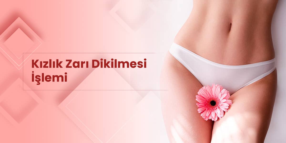 Kızlık Zarı Dikimi Yorumları