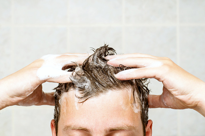 Saç Ekiminden Sonra Kısa Saç Bakımı Nasıl Yapılır?