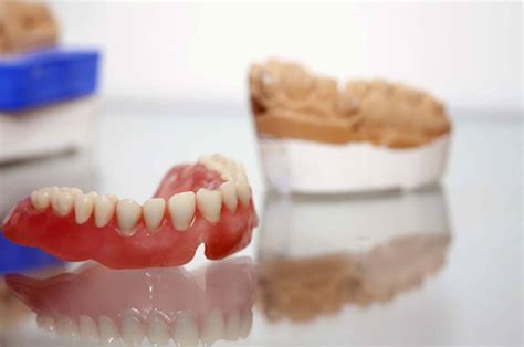 Sabit Protez Diş Kullananların Yorumları