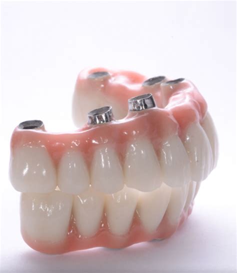 Sabit Protez Diş Kullananların Yorumları