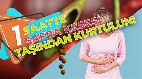 Safra Kesesi Ameliyatı Olanlarin Yorumları