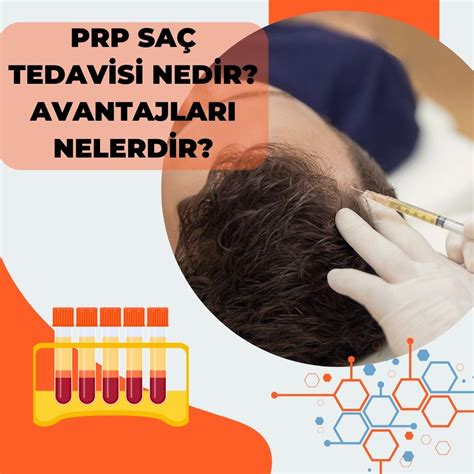 PRP Saç Tedavisi Nedir?