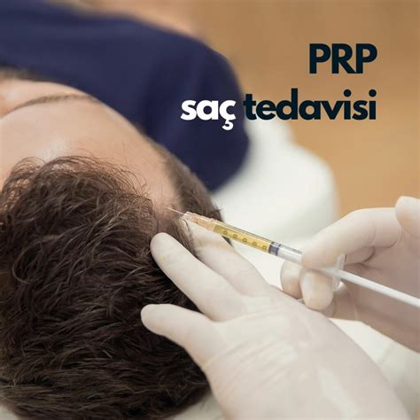 PRP Saç Tedavisi İşe Yarıyor mu?