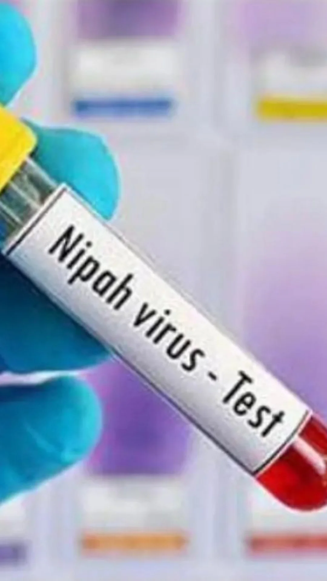 Signs and Symptoms of Nipah Virus